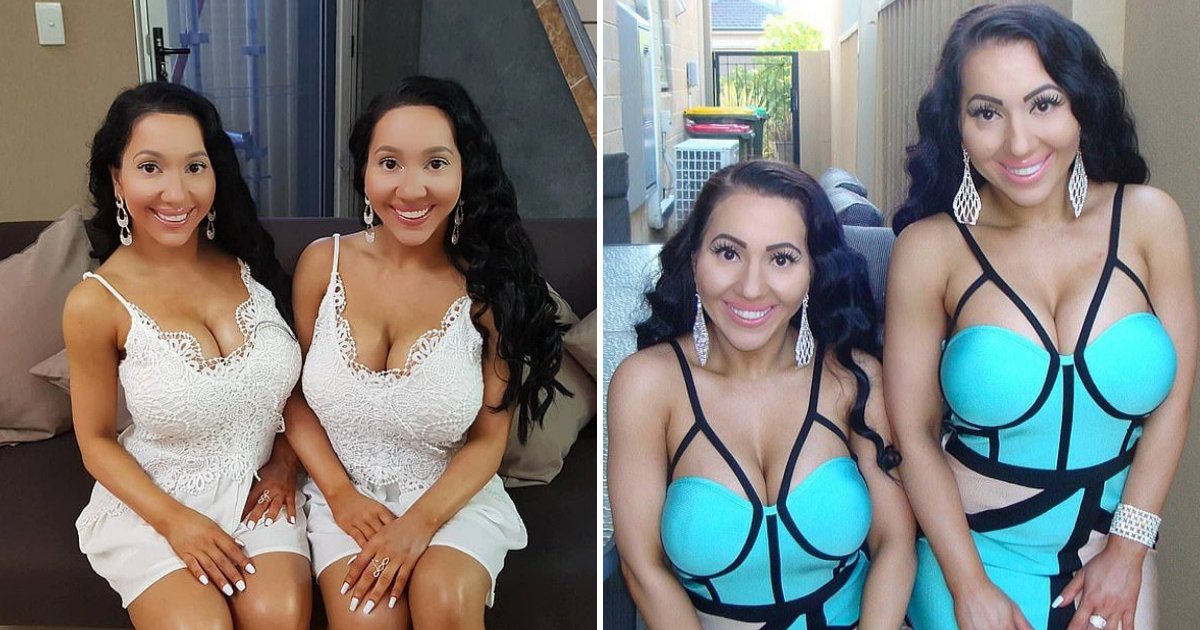 World S ‘most Identical Twins Spent 250k On Plastic Surgeries To Look Even More Alike Small Joys