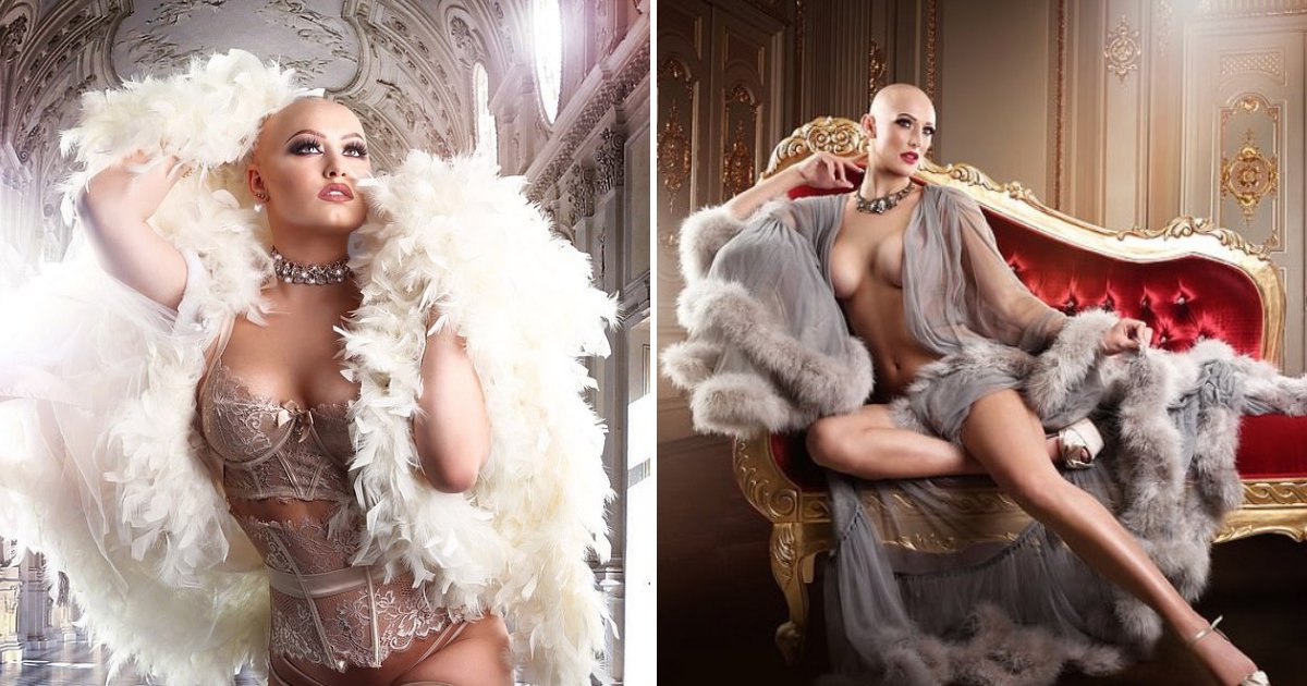 alopecia4.png?resize=412,232 - Women With Alopecia Transformed Into Lingerie Models To Show That Bald Is Beautiful