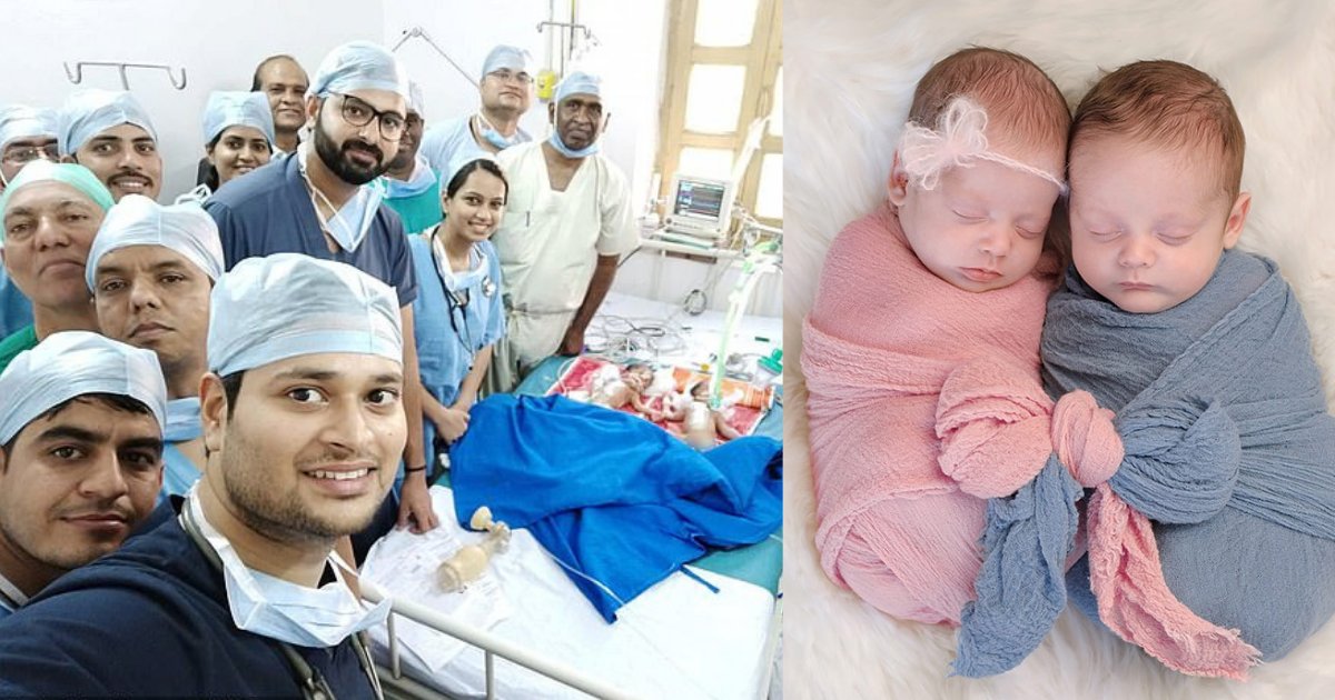 d1 9.png?resize=1200,630 - Surgeons Shared A Selfie After Successfully Performing Separation Surgery On 3-Day-Old Conjoined Twins