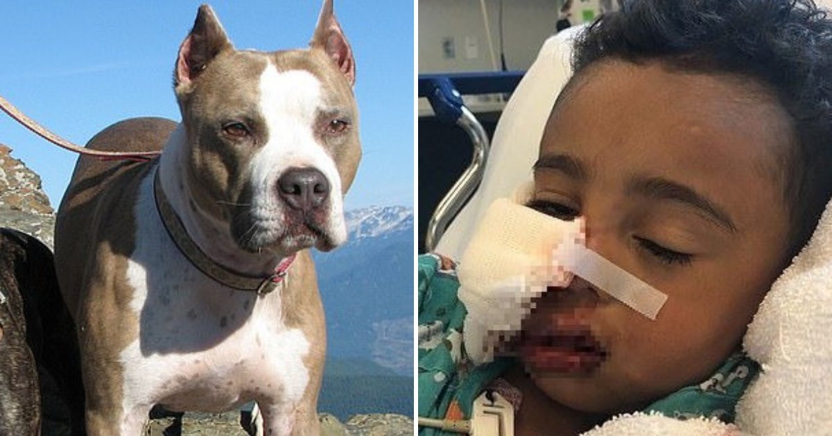 pitbull.png?resize=412,275 - Un Pit Bull a attaqué un garçon de 3 ans, le laissant avec des lésions au visage et des gencives ravagées