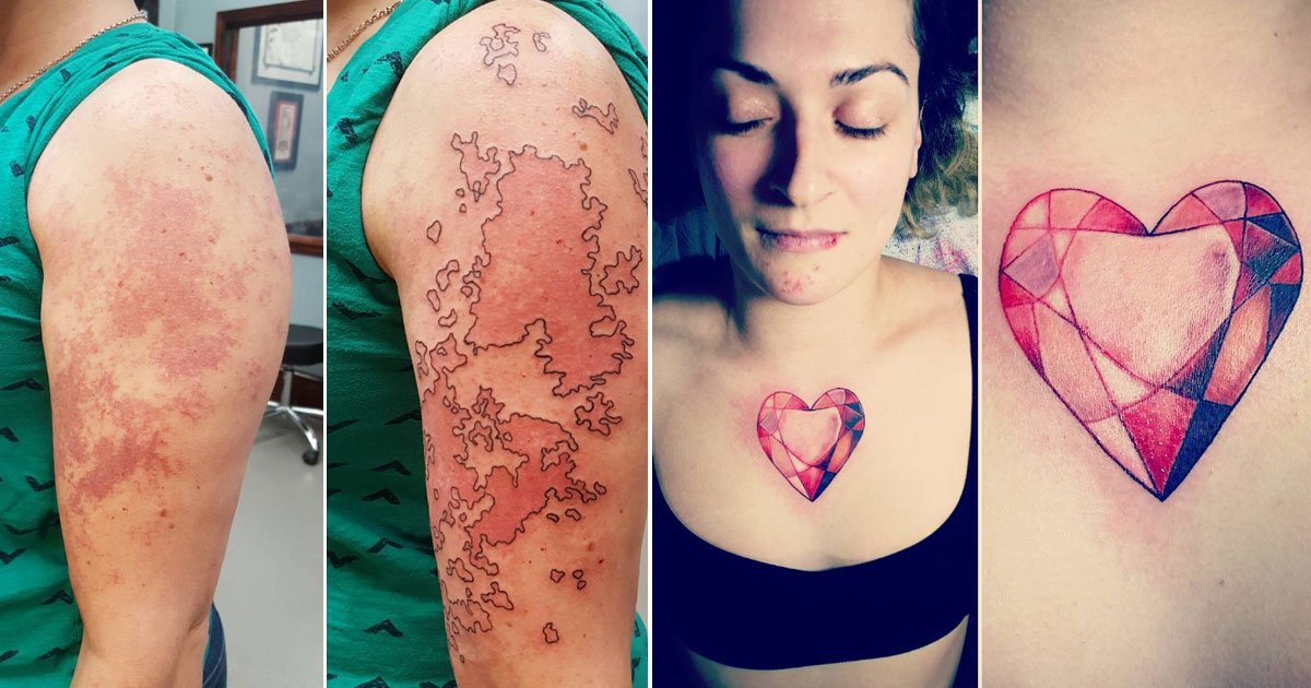 untitled 1 16.jpg?resize=1200,630 - 15 superbes tatouages qui transforment des taches de naissance et des cicatrices en œuvres d'art