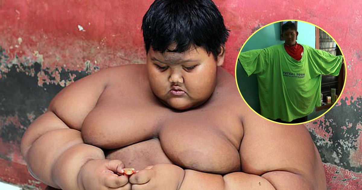 world fattest boy lost weight.jpg?resize=412,232 - World’s Fattest Boy Lost Nearly Half Of His Body Weight In Life-Changing Weight Loss Journey