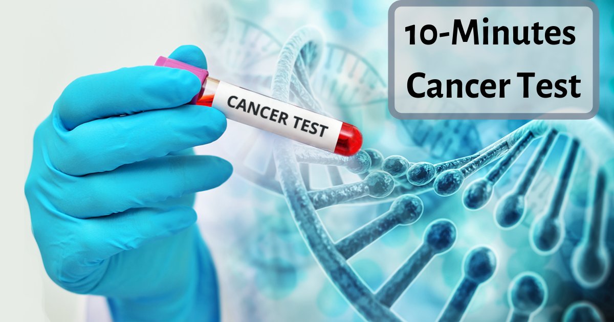 y3 4.png?resize=1200,630 - Des chercheurs ont mis au point un test qui détectera les cellules cancéreuses dans le corps en seulement 10 minutes