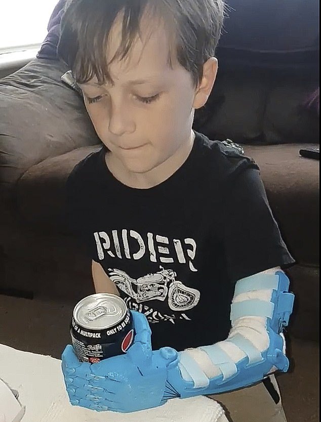 Bras bioniques avec une imprimante 3D