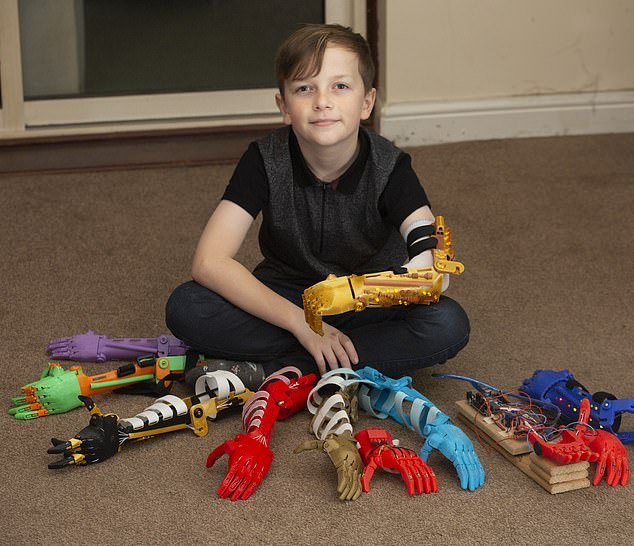 Bras bioniques avec une imprimante 3D