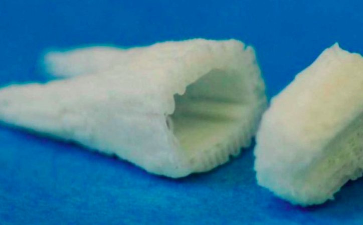 img 5c379e6152ad7.png?resize=1200,630 - Des implants dentaires de cellules souches font pousser de nouvelles dents en 2 mois !