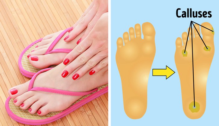 6 Types of Shoes That Can Do Too Much Damage to Your Body