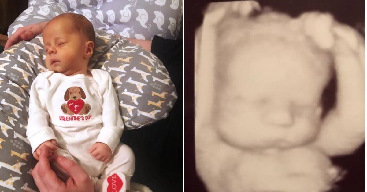 babyboy5.png?resize=412,275 - Mother Checked Ultrasound Photo And Noticed Something About Baby's Sleeping Position