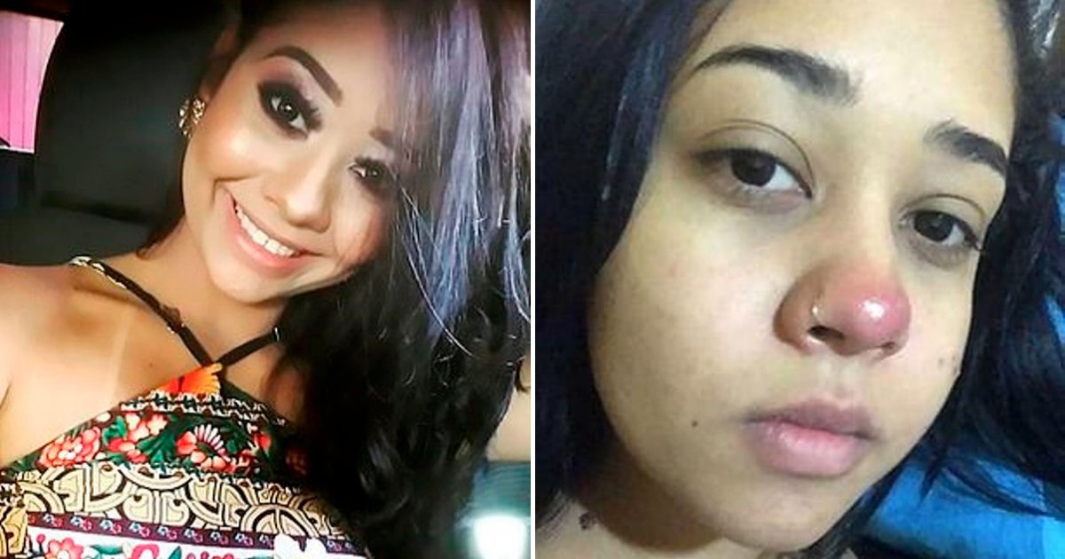 dias5.png?resize=412,232 - 20-Year-Old Woman Left In Wheelchair For Life After Getting Her Nose Pierced