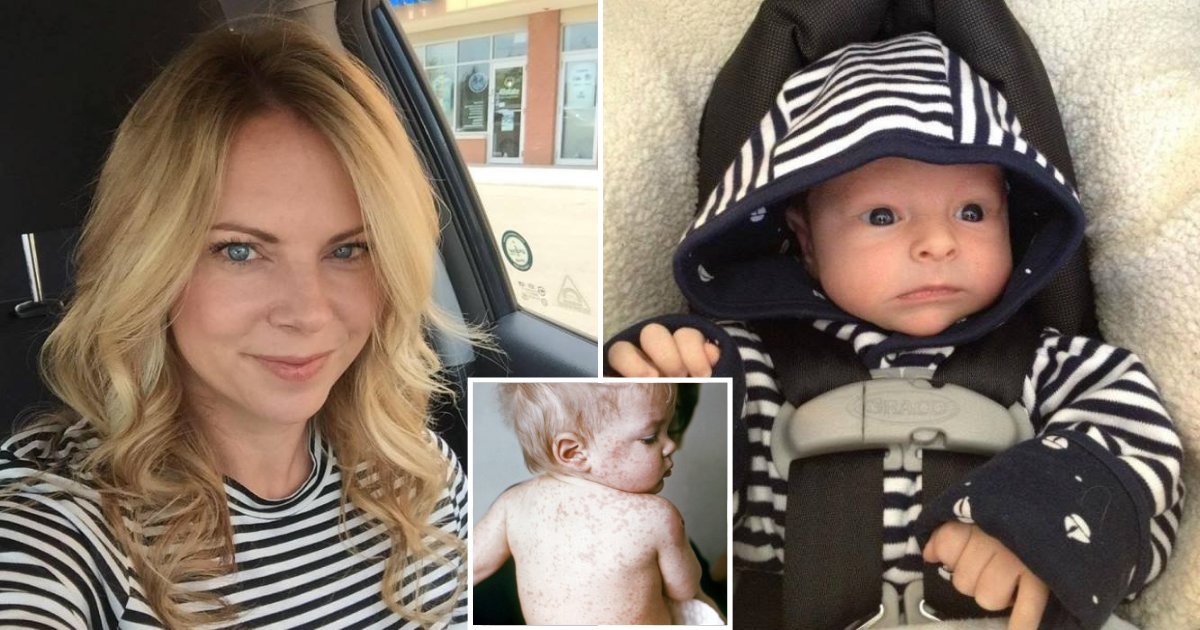 measles4.png?resize=1200,630 - Mother Outraged At Anti-Vaxxers After 15-Day-Old Son Got Measles