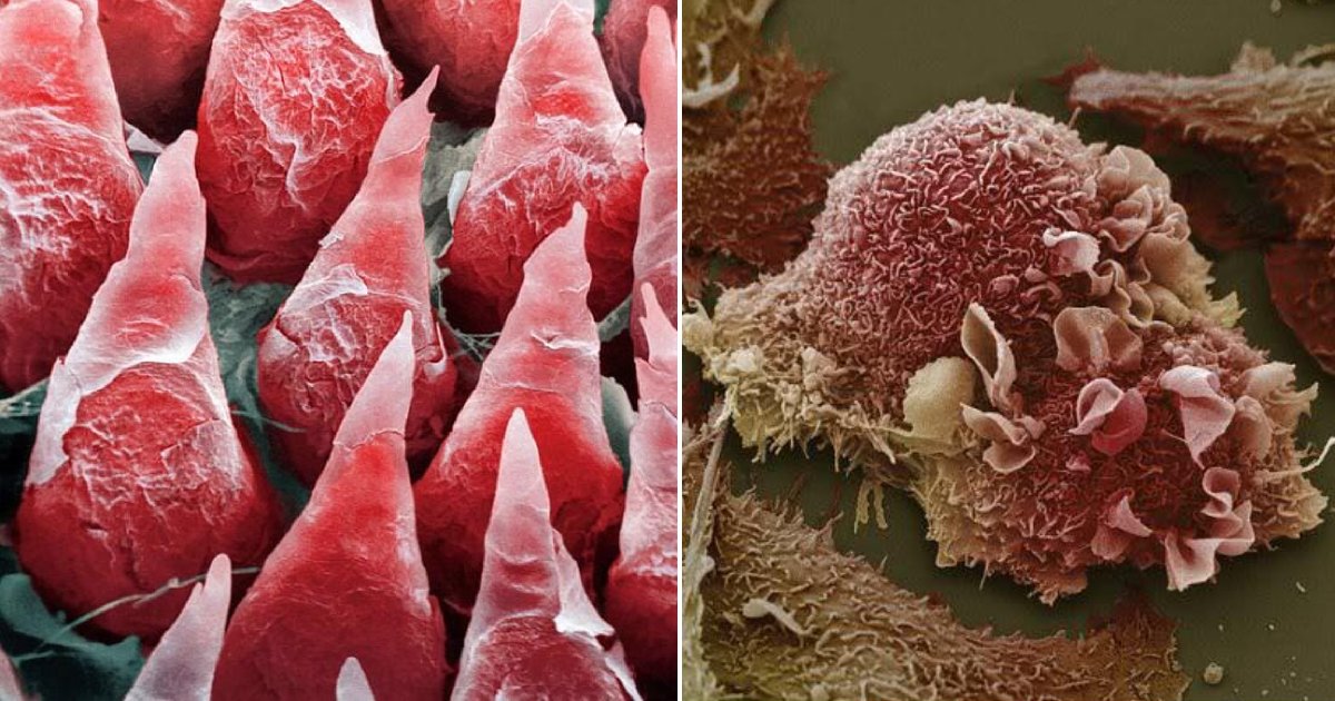 organ micro.png?fit=1024%2C538&ssl=1&strip=all - How Human Organs Look Like Under A Microscope