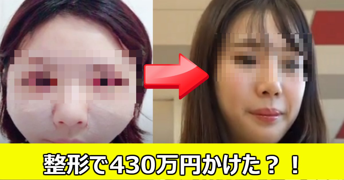 seikei.png?resize=412,275 - 430万かけて整形した？24歳女性の現在の思いとは？