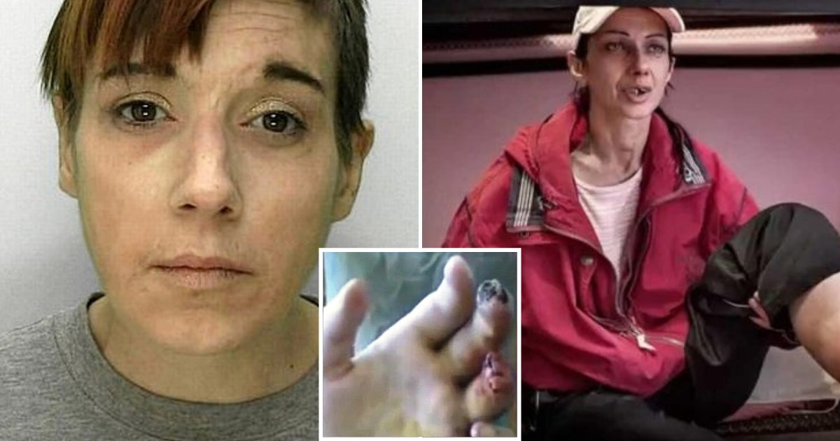 sores.png?resize=412,275 - Une femme devient la première personne à tomber malade du médicament le plus meurtrier au monde, «Krokodil»