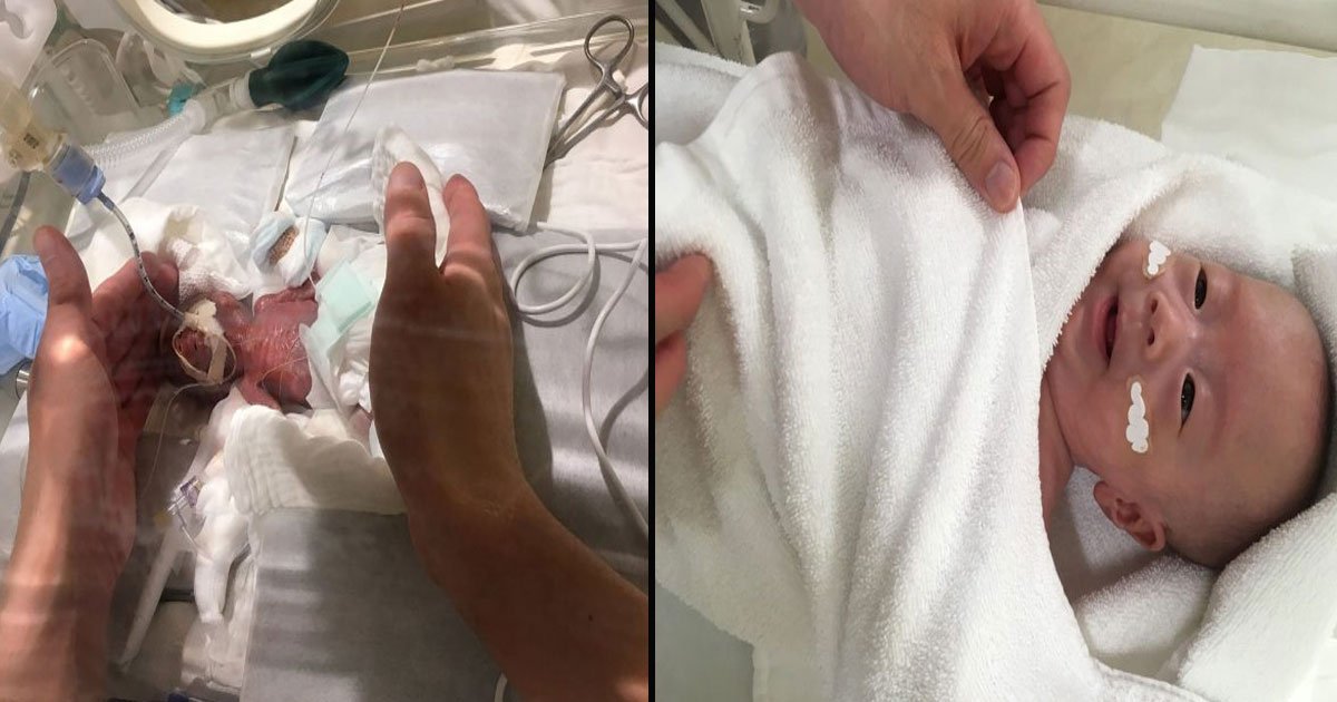 untitled 1 59.jpg?fit=1024%2C538&ssl=1&strip=all - World's Smallest Surviving Baby Boy Ever Born Weighing 1lb Finally Goes Home