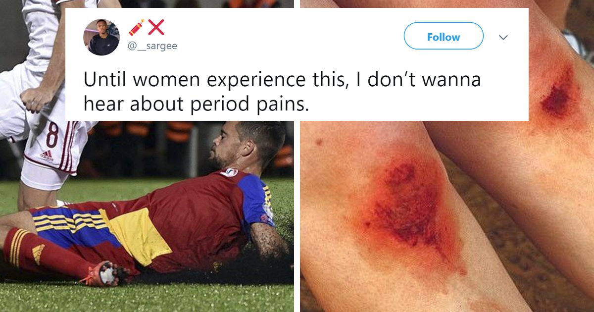 a 3.png?resize=1200,630 - Man Got Mocked On Twitter For Claiming 'Skinned Knees' Hurt More Than 'Period Cramps'
