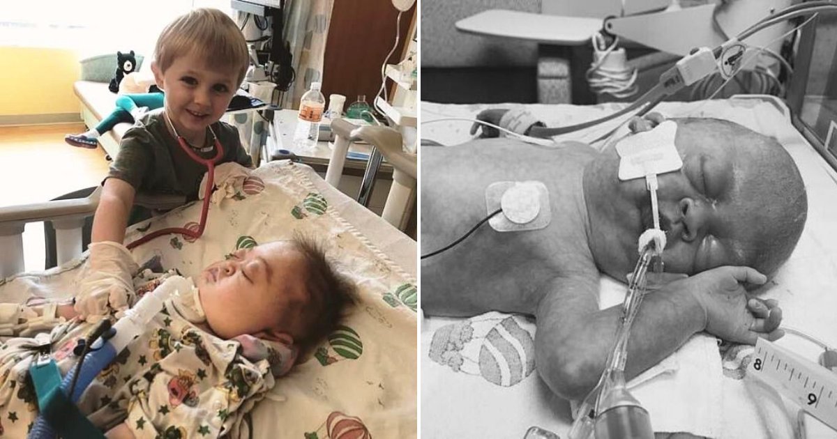 charlotte6.png?fit=1024%2C538&ssl=1&strip=all - 'Miracle' Baby Born With Ultra-Rare Genetic Deformity Defies Doctors' And Parents' Expectation