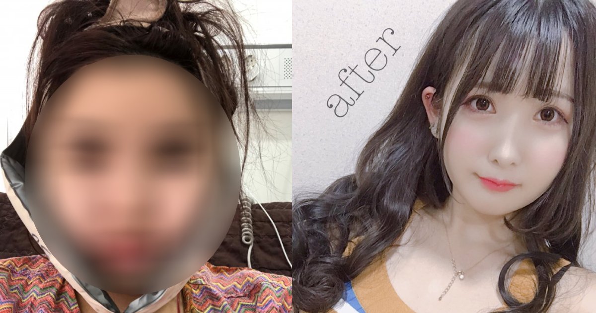 e696b0e5a29ee5b088e6a188 15 1.png?resize=412,275 - 1500万円かけた整形美女、きっかけは父の一言…「お前の顔は他人を不幸にする」！？