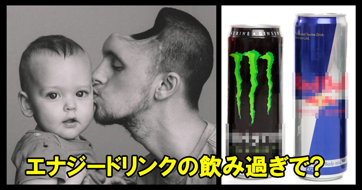 energydrink ttl.jpg?resize=412,275 - エナジードリンクの飲み過ぎで脳が半分になった夫