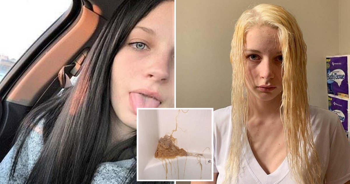 Teenager Lost Piles Of Hair After Trying To Bleach Her Locks With
