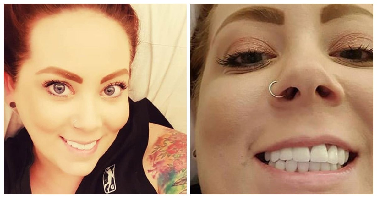 teeth.jpg?resize=1200,630 - Une Australienne affiche son nouveau sourire fantastique après avoir dépensé 4 800 € pour la reconstruction de sa bouche entière
