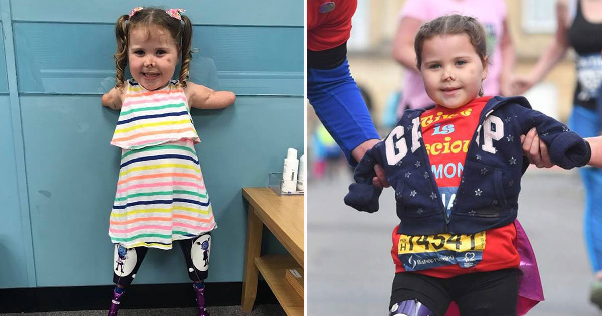 toddler without limbs marathon.jpg?resize=1200,630 - Une fillette qui a perdu ses membres a complété son premier marathon