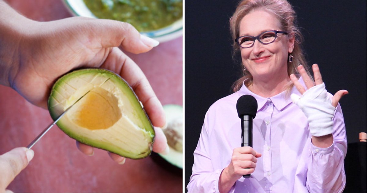 y4 12.png?resize=412,232 - Doctors Say Avocado Hand Is Becoming A Real Problem and They Need Labels to Protect People From Them