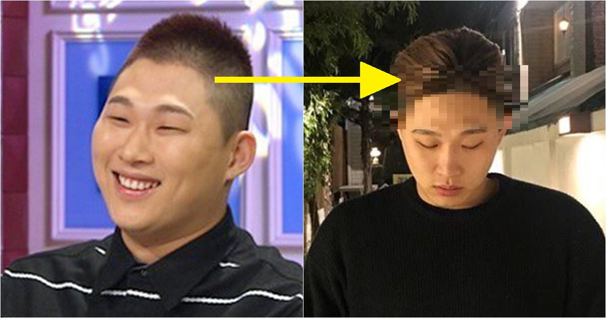 26.png?resize=1200,630 - 스윙스로 보는 '헤어라인'의 중요성