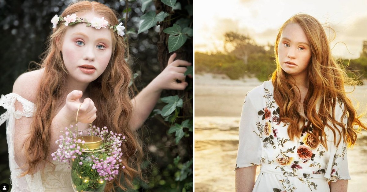 8 17.jpg?resize=1200,630 - Madeline Stuart Became A First Model With Down Syndrome - Inspiring Millions Others
