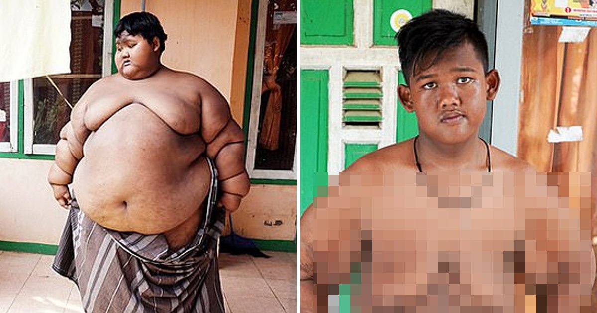 9 15.jpg?resize=1200,630 - 세계에서 가장 뚱뚱했던 소년의 놀라운 '다이어트' 근황.jpg