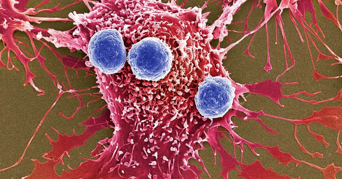 a.jpg?resize=1200,630 - De nouvelles études ont trouvé une immunothérapie qui peut réduire les tumeurs incurables à un stade avancé