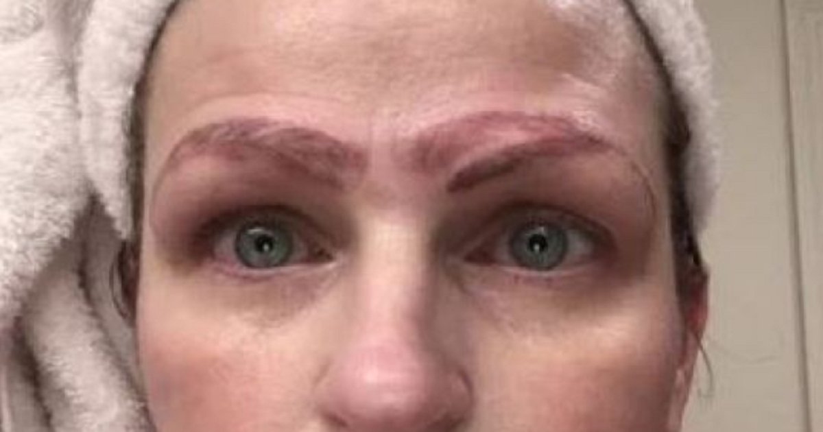 b3.png?resize=412,232 - Botched Microblading Procedure Left A Woman With Four Eyebrows
