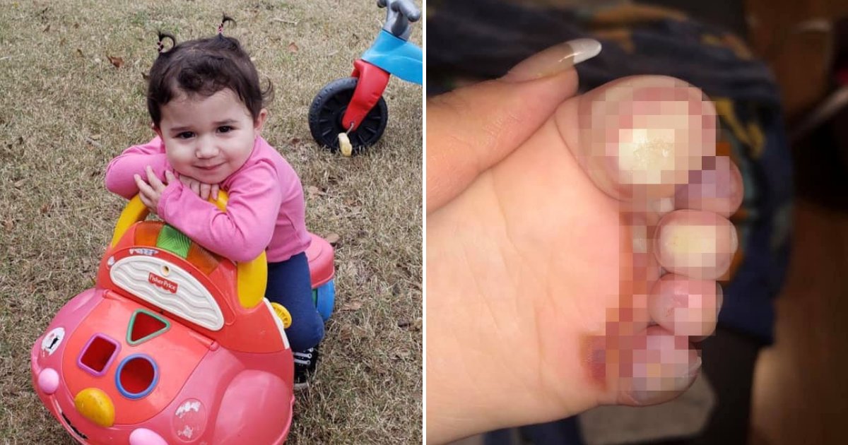 babyfeet.png?resize=1200,630 - Mother Shares Grave Warning After Pair Of Shoes Left Toddler's Feet With Third-Degree Burns