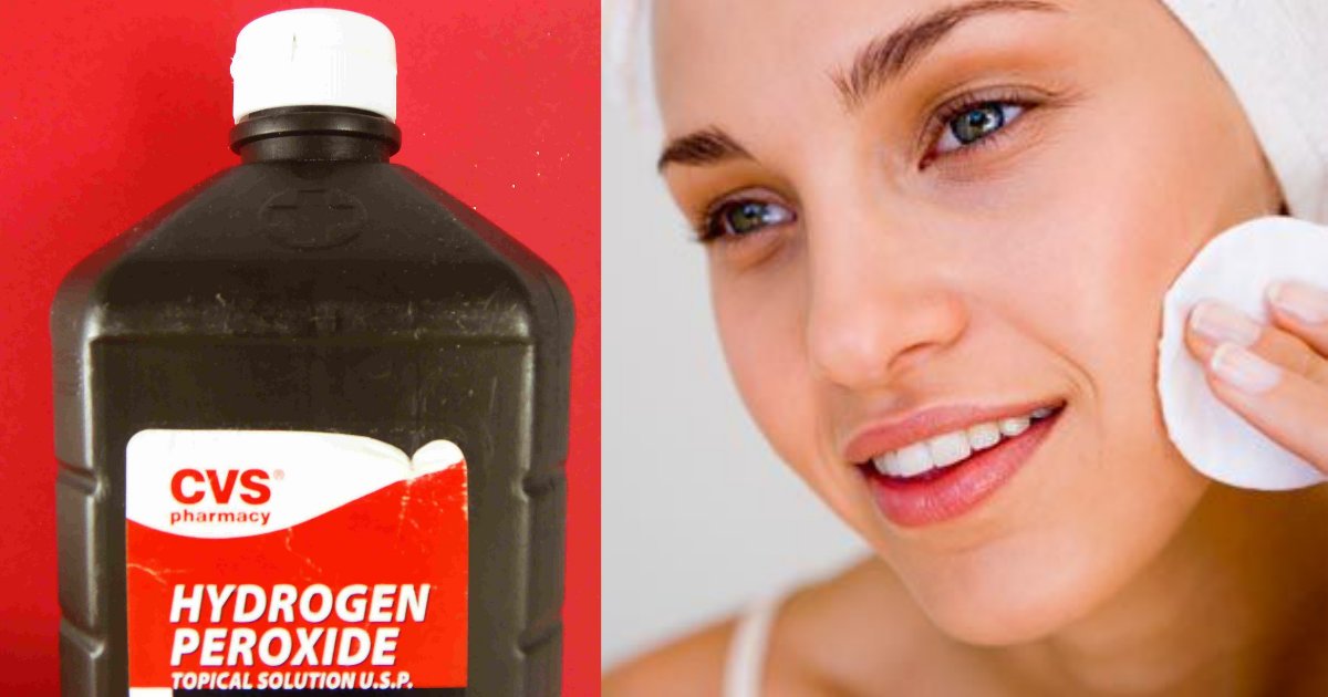 d4 8.png?resize=412,232 - How Can Hydrogen Peroxide Be Used in 7 Different Ways?