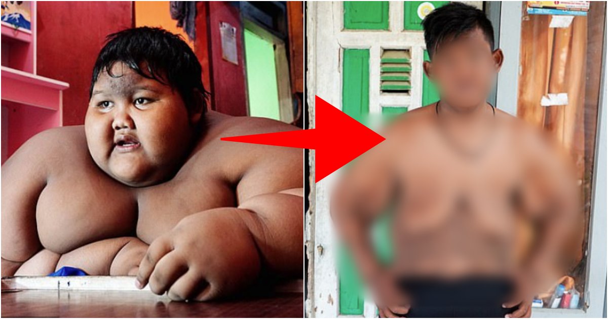 dsxcv.png?resize=1200,630 - 세계에서 '가장' 뚱뚱했던 소년의 놀라운 '다이어트' 근황.jpg