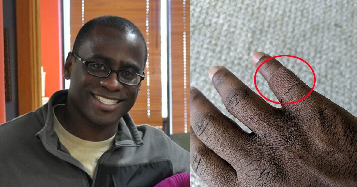 mans viral post about bandage that matched his skin tone received overwhelming response.jpg?resize=1200,630 - Man Shared His Emotional Experience Of Putting On A Bandage In His Skin Tone For The First Time