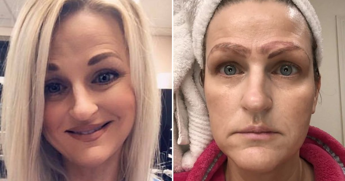 mother6.png?resize=412,232 - Woman Dumped By Boyfriend After Botched Treatment Left Her With FOUR Eyebrows
