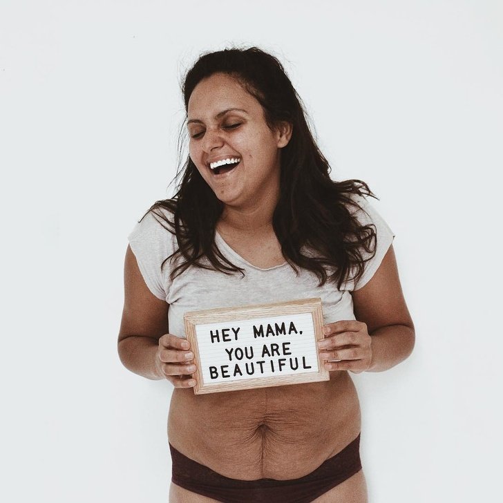 A Mother of 5 Posted Her Belly Photo to Prove the Woman Body Is Always Beautiful, and the Support She Got Is Immense
