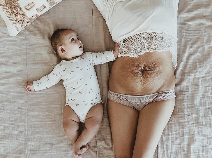 A Mother of 5 Posted Her Belly Photo to Prove the Woman Body Is Always Beautiful, and the Support She Got Is Immense