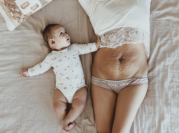 AÂ Mother ofÂ 5Â Posted Her Belly Photo toÂ Prove the Woman Body IsÂ Always Beautiful, and the Support She Got IsÂ Immense