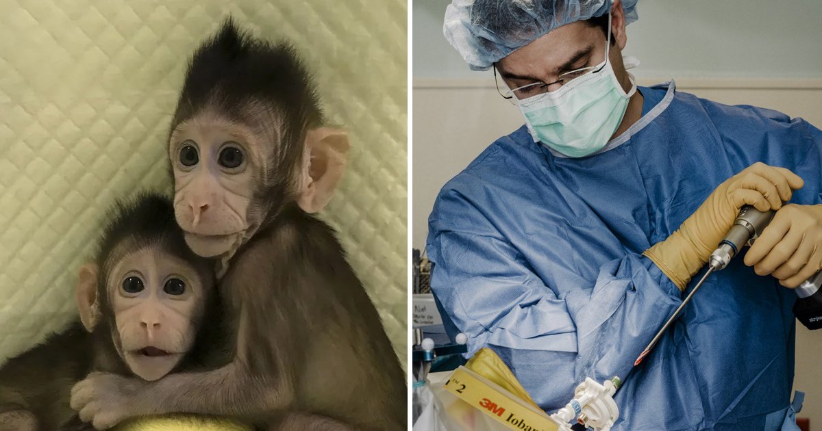 Scientists Implanted A Human Brain Gene Into Monkeys - Small Joys