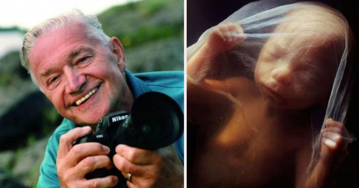 59.jpg?resize=1200,630 - Comment un enfant naît : un photographe suédois a passé 12 ans de sa vie à prendre des photos d'un fœtus en croissance dans le ventre