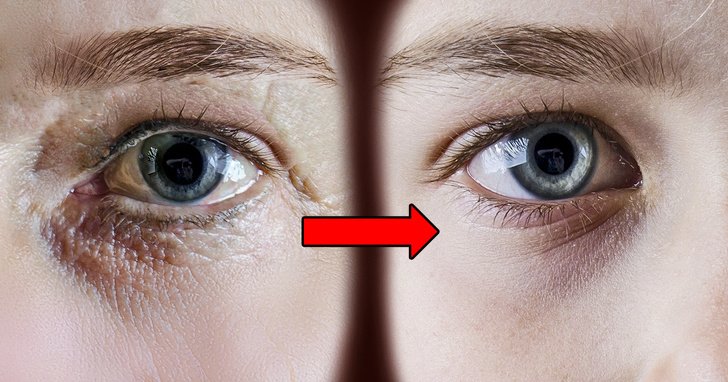 7 Ejercicios antiarrugas que pueden quitarle años a tu rostro