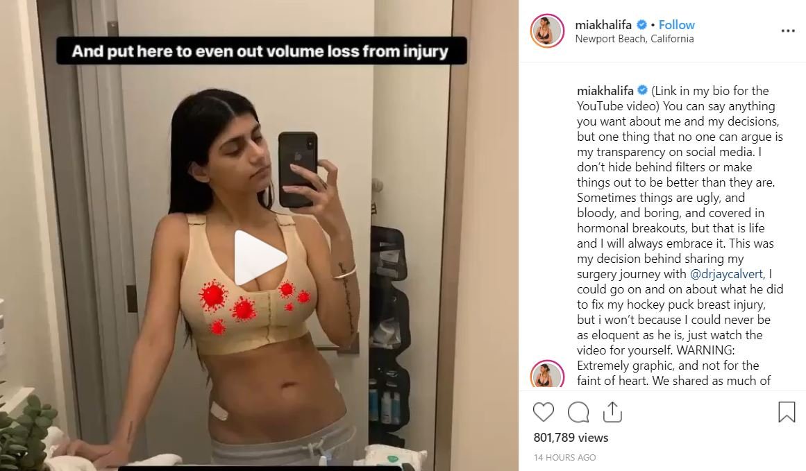 Mia khalifa shared a video from her breast surgery after she was hit by