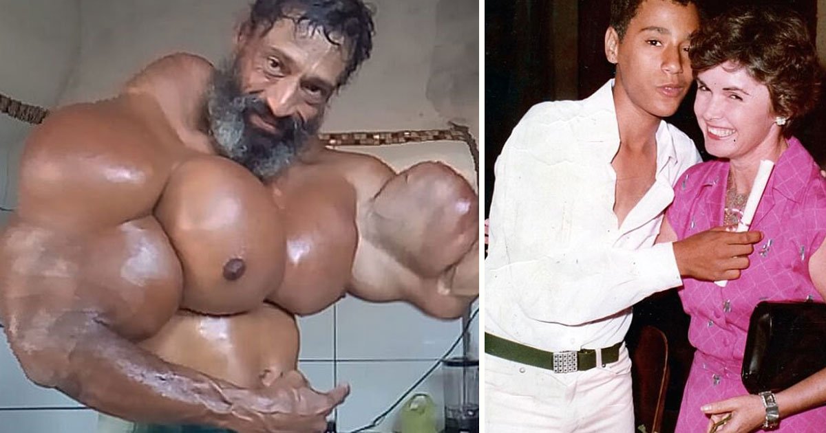 bodybuilder synthol.jpg?resize=1200,630 - Bodybuilder Who Was Once A Skinny Addict Is Risking His Life By Using Synthol Injections To Boost His Muscles