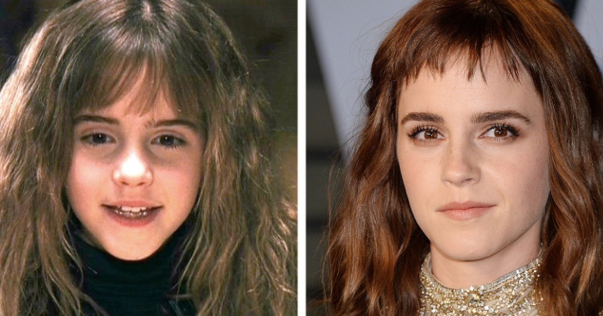 child stars.png?fit=1024%2C538&ssl=1&strip=all - 12 Famous Child Stars Who Grew Up To Match Their Fame