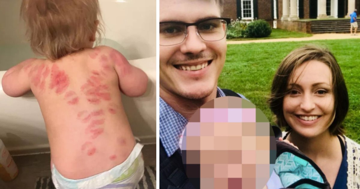 d2 1.png?resize=412,232 - Mother Found 25 Bite Marks On Daughter's Back After Picking Her Up From Nursery