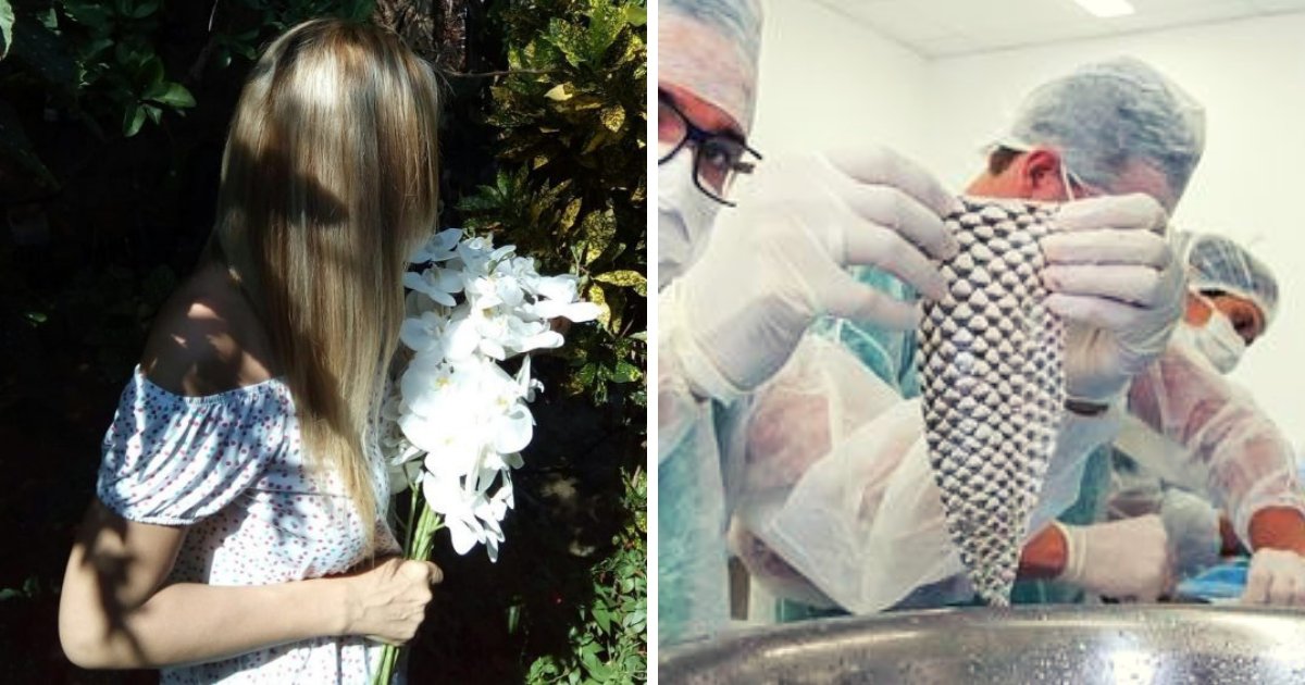 fish4.png?resize=1200,630 - Trans Woman Becomes The 'First In The World' To Have A Vagina Made From Fish Skin