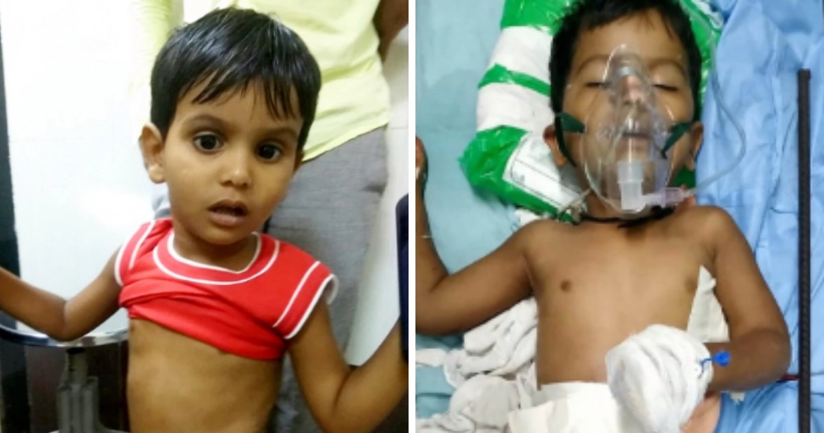 nadeem5.png?resize=412,232 - Un bambin de 3 ans survit après avoir été empalé par une tige de fer de 180 cm de long après une chute de 9 mètres d'un bâtiment