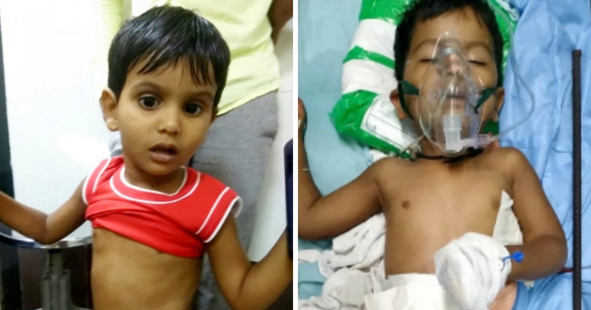 nadeem5.png?resize=412,275 - 3-Year-Old Toddler Survives Being Impaled By 6ft-Long Iron Rod After Falling 30ft From Building