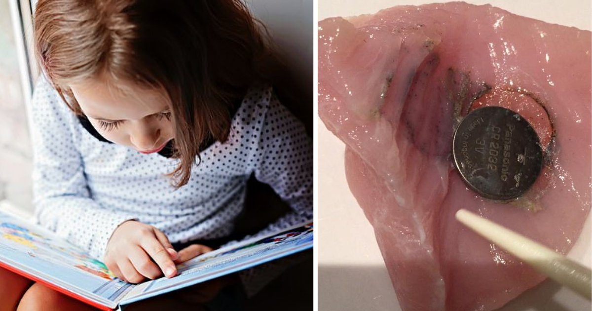 s2 17.png?resize=412,232 - Horrifying Images Showing the Result of Kids Swallowing Button Battery, WARNING for parents